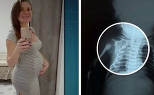 Bebê baleado na barriga da mãe no Rio respira sem ajuda de aparelhos