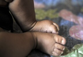 Covid-19 mata duas crianças menores de 5 anos por dia no Brasil